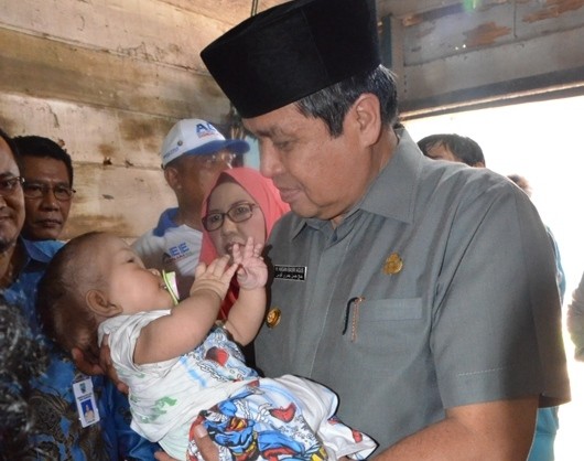 HBA menggendong seorang bayi penderita hydrocefalus