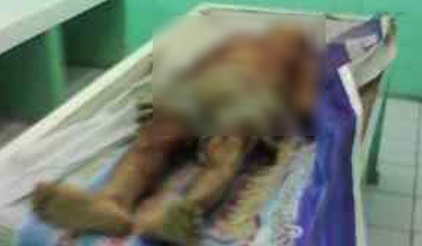 <b>Foto:</b> Korban bentrok Sungai Bahar