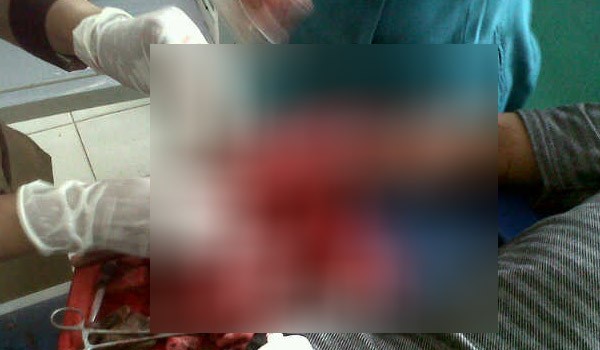 Korban pembacokan yang dirawat dirumah sakit beberapa waktu yang lalu