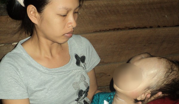 Yuli berada di pangkuan ibundanya. Keterbatasan biaya membuat Yuli tidak bisa mendapatkan pengobatan yang layak.