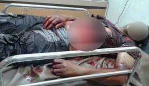 Salah satu korban saat berada di rumah sakit Islam Arafah Jambi