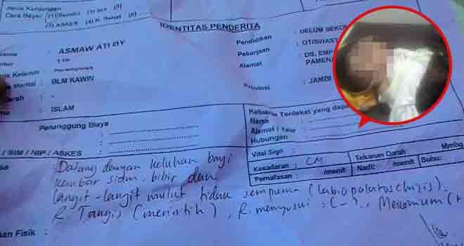 Bayi kembar siam saat mendapat perawatan di Rumah Sakit Umum H Hanafie Bungo sebelum dibawa keluarganya pulang ke Merangin.