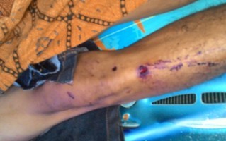 Bekas luka yang ada di kaki Agus