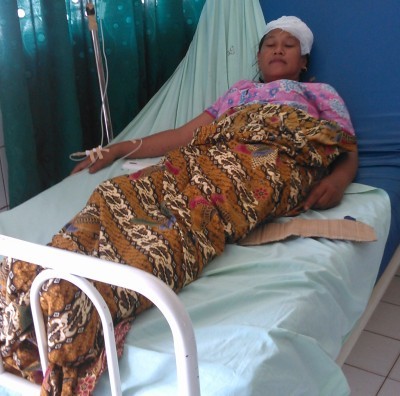 Korban Fatmi saat dirawat di RSU Kolonel Abundjani Bangko