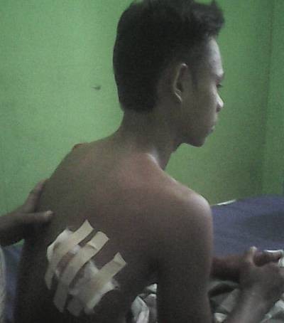 Korban Haris saat dirawat di UGD Simpang Dusun Sungai Lilin (Lubuk Landai).