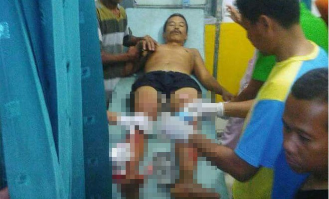 Sahak (40), Warga Bungo yang diterkam Buaya mendapatkan perawatan medis.