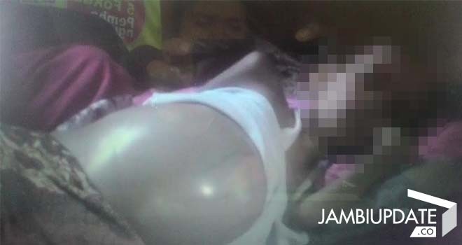 Rianti, bocah berumur 10 tahun yang mengidap tumor ginjal stadium 3.