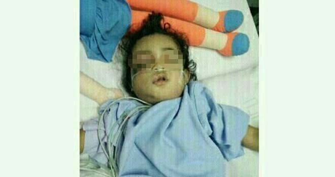 Fania, anak berumur 2 tahun yang dipatuk ular di bagian mata.