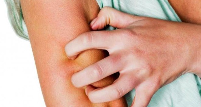 Ilustrasi. Foto : Net