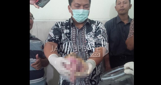 Bayi lahir yang menjadi mumi di RSUD Raden Mattaher Jambi.