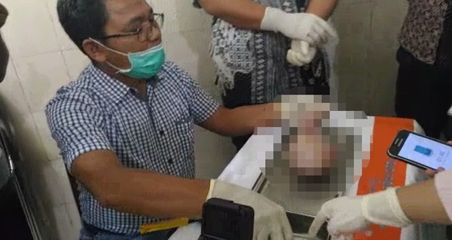 Bayi Mumi saat Ditangani Tim Dokter.