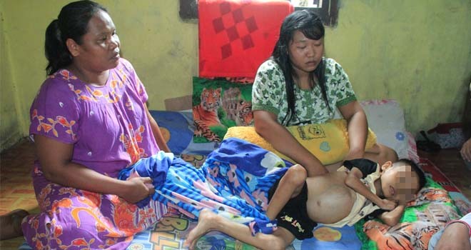 Rifaldo, bocah 5 tahun yang mengidap kanker ganas hanya bisa terbaring lemah dirumah.