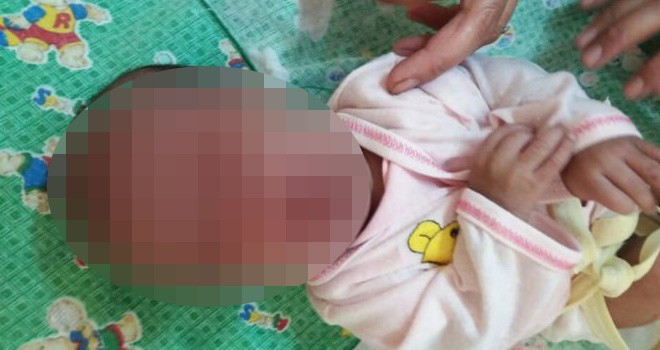 Bayi 1,5 bulan ini dilempar ayahnya ke tungku masak karena lapar. Foto via Humas Polda Jabar