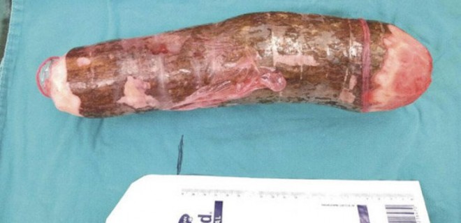 Singkong ini dijadikan alat bantu seks.