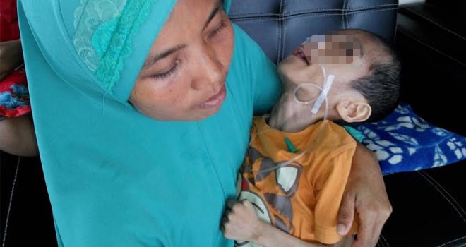 Juliana (30) saat menggendong Muhammad Alfin (10) yang mengalami radang paru.