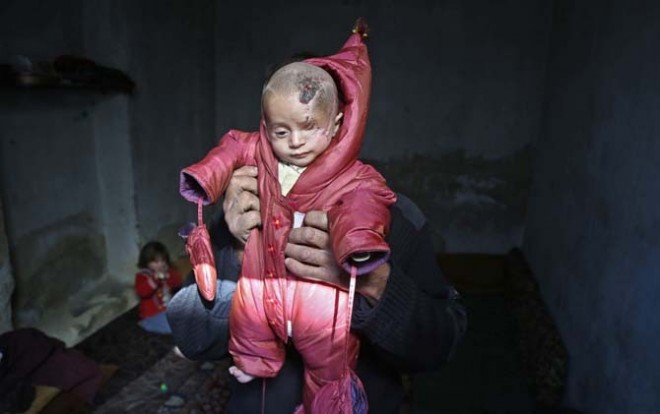 Karim Abdallah digendong ayahnya. (Handout / #SolidarityWithKarim campaign / AFP)