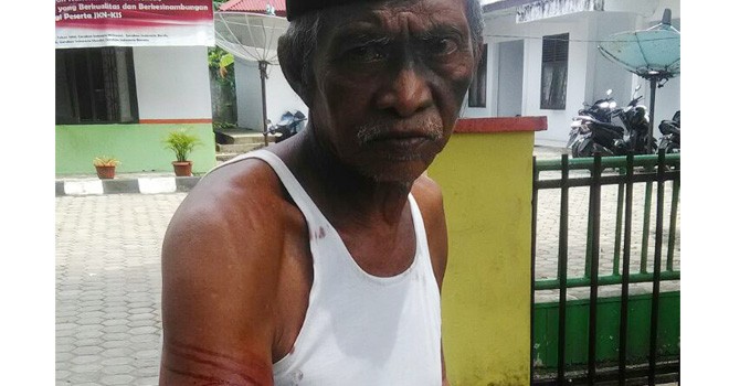 Korban yang digigit anjing.