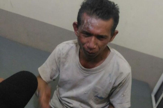 Pemilik Toko yang Terjebak dan Terpaksa Melawan Kobaran Api.