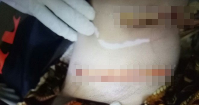 luka pada tubuh korban.