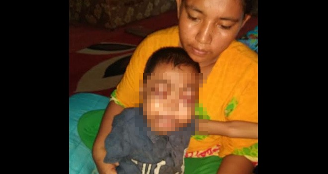 Imron, anak berusia 6 Tahun menggidap penyakit aneh.