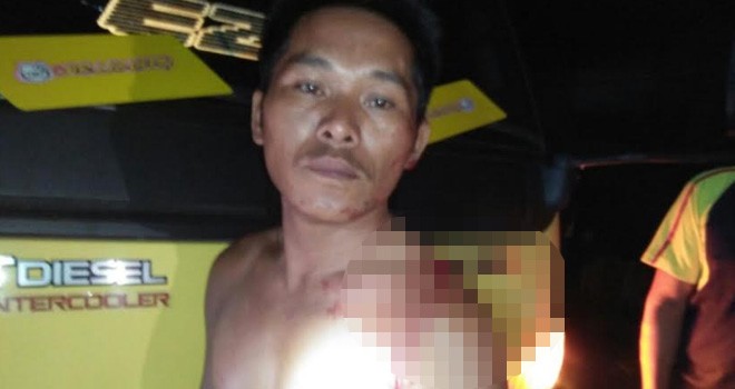 Korban Sapri saat berada di lokasi kejadian dengan luka bacok di bagian bahu usai kejadian, Selasa (3/7) malam.   