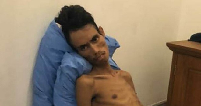 Kondisi petinju yang sempat menghuni pelatnas Asian Games 2018, Valentinus. Foto : JPNN