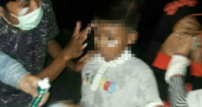 Anak-anak yang Terkena Gas Air Mata.