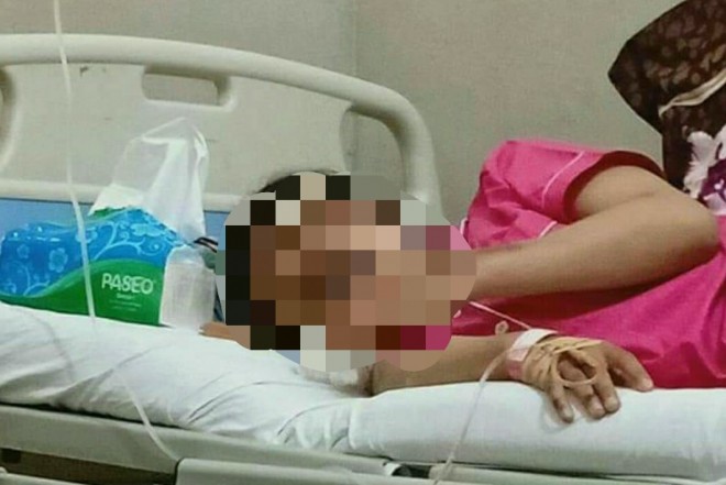Terlihat korban luka parah
