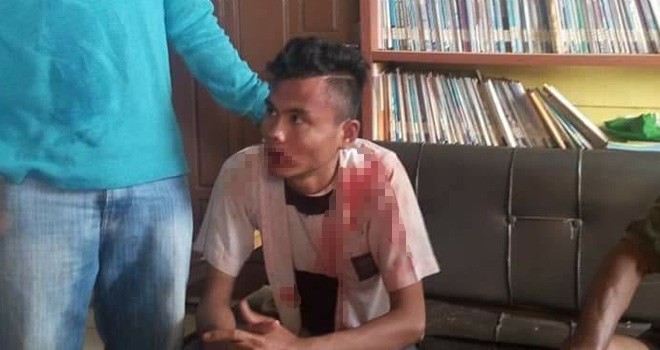 Tersangka Henrifal babak belur usai kepergok mencuri di SMKN 4 Tebo, Senin (27/8).
