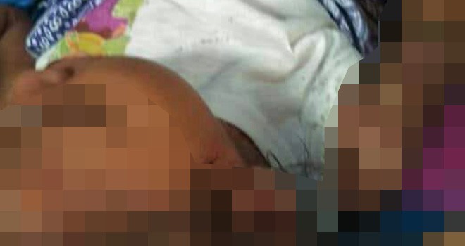 Foto Afifah, Diduga yang menjadi korban vaksin rubella.