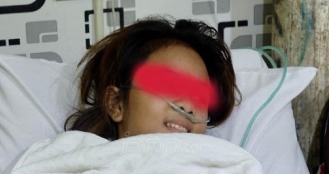 Audrey, siswi SMP yang diduga dianiaya 12 pelajar putri tingkat SMA.