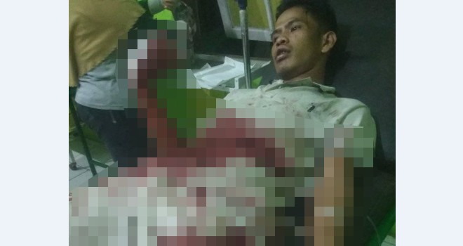 Firdaus (23), warga Desa Pematang Gadung, Kecamatan Mersam, yang merupakan seorang sopit truk batu bara menjadi korban aksi pelaku begal. Foto : Ist