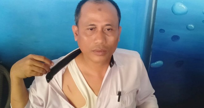 Kepala Desa Sengkati, Baru Hendrianto menunjukkan bekas luka dibagian dada tangan dan kepala bagian belakang akibat diserang oleh kelompok SMB. Foto : Ist