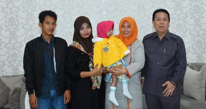 Pemkab Batanghari Tanggung Biaya Operasi Nayla Penderita Pierre Robin Syndrom.