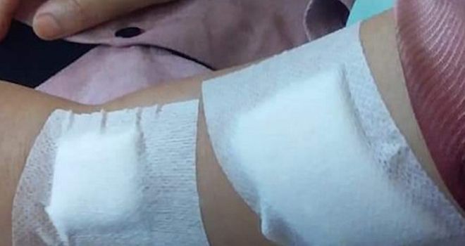 Tangan kiri IRT tersebut robek setelah terkena tebasan senjata tajam (sajam) yang digunakan pembegal untuk merampas barang berharga milik korban.