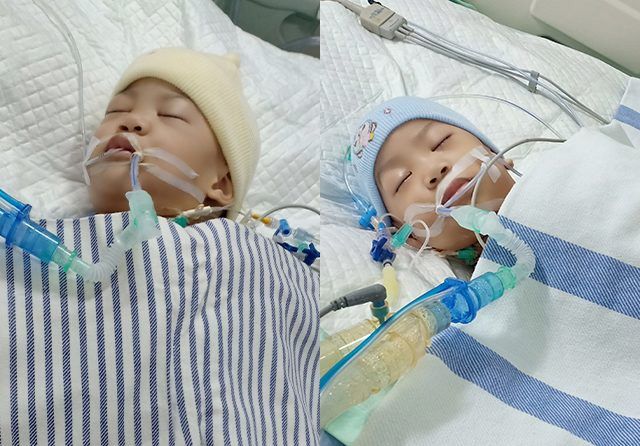 MASA KRITIS: Akila (kiri) dan Azila dirawat di ruang ICU kemarin (15/8). Akila sempat demam, tapi itu dianggap wajar oleh tim dokter. Kedua orang tua diminta untuk selalu menemani mereka. (Allex Qomarullah/Jawa Pos)