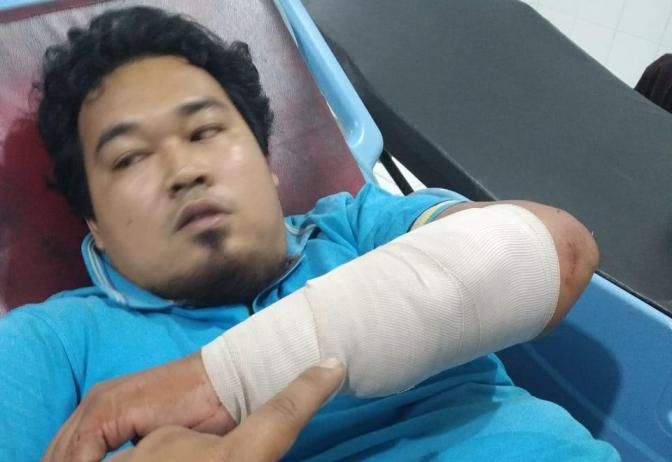 Salah satu korban saat dirawat di rumah sakit di Batanghari semalam (29/8).