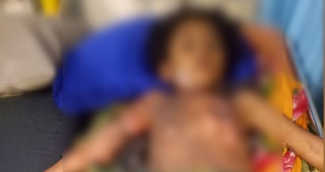 Korban ledakan lampu pelita minyak tanah, Kamis malam, 19 September.