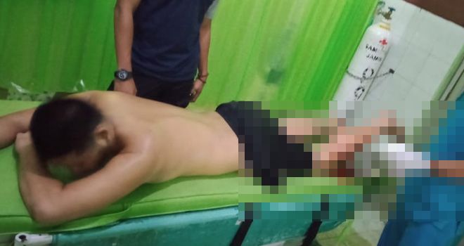 Pelaku Penyiraman Janda di Merangin Pakai Air Keras Dihadiahi Timah Panas oleh Polisi. 