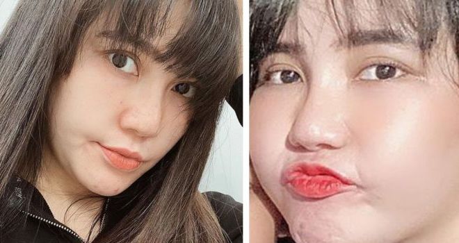 Via Vallen dulu dan sekarang.