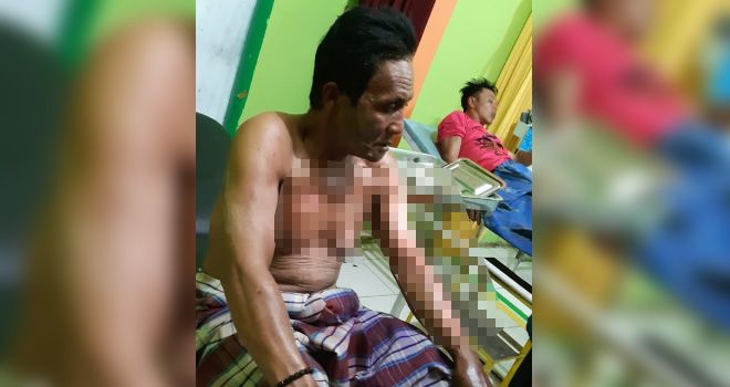 Warga Kayu Aro Alami Luka Bakar Saat Padamkan Api.