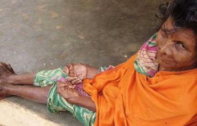 Kumari Nayak Wanita India dengan Jari Terbanyak.