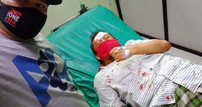 Eggi Sudjana Alami Kecelakaan Tunggal.