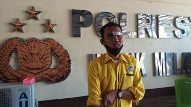 Sekretaris DPD II Golkar Majene, Muhammad Irfan Syarif memperlihatkan lukanya usai dianiya oleh puluhan orang tak dikenal (OTK) di lobi Hotel d'Maleo, Minggu dini hari, 19 Juli.