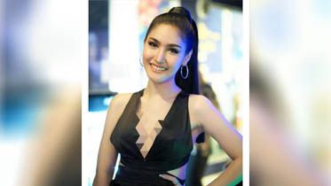 Operasi Kelamin, Alat Vital Ratu Kecantikan Ini Bau Busuk