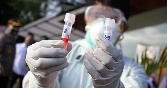 ILUSTRASI. Jumlah pasien terkonfirmasi positif Covid-19 dalam 24 jam terakhir bertambah 1.462 orang. Sehingga jumlah total kasus positif mencapai 83.130 orang. (Dery Ridwansah/ JawaPos.com)