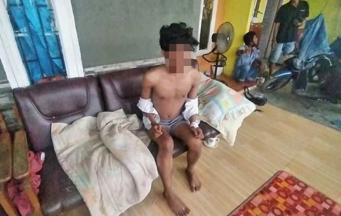 Aksi Begal Kembali Terjadi di Kota Jambi, Korban Alami Luka Bacok