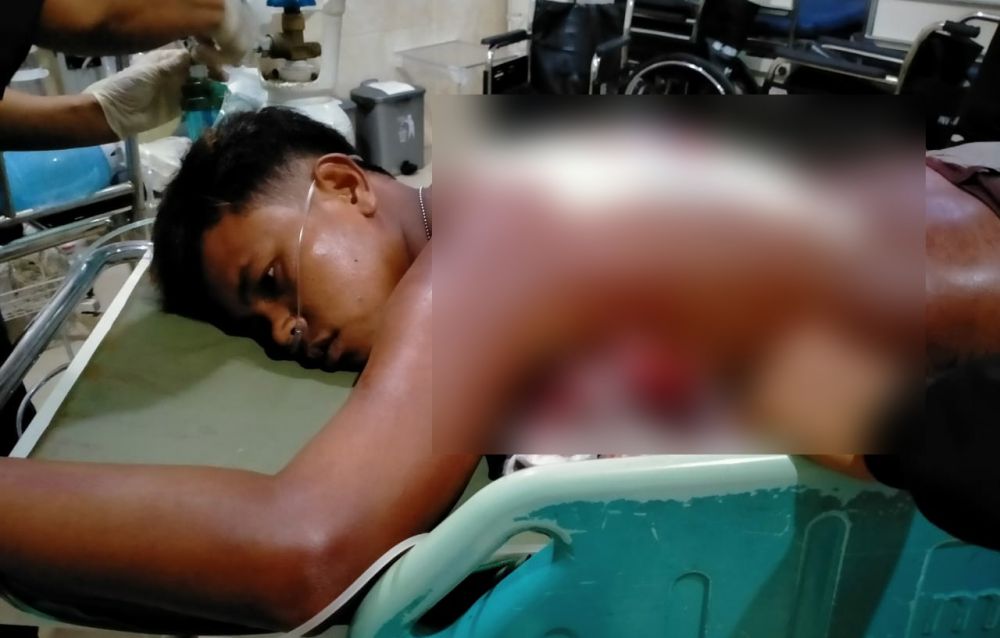 M. Syamsuddin usai ditusuk oleh segerombolan orang yang tidak dikenal (OTK) harus mendapatkan perawatan di rumah sakit