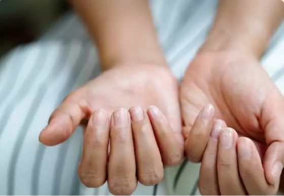 Beberapa ahli telah menunjukkan bukti gejala yang dapat muncul pada kuku pasien setelah sembuh dari Covid-19.	