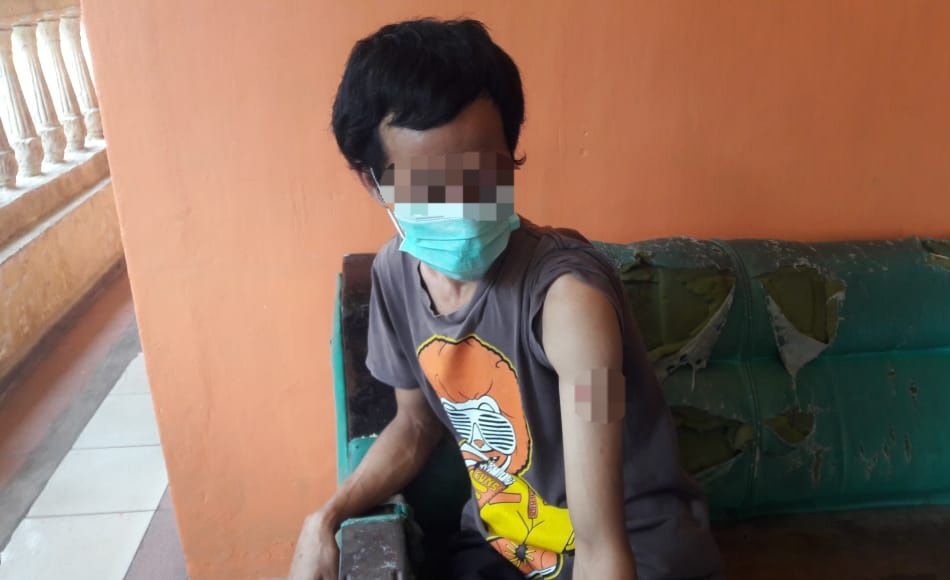 Korban Damsi memperlihatkan bekas penambakan senapan angin